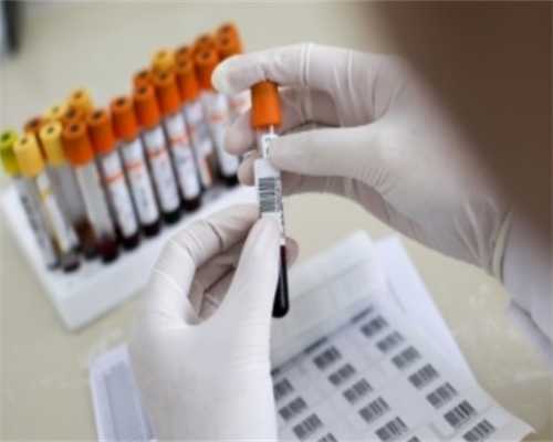 输卵管造影后多久可以出结果~官网无忧助孕中心